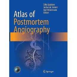 Atlas of Postmortem Angiography - 9783319803722