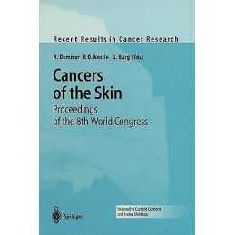 Cancers of the Skin - 9783642639692