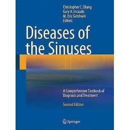 Diseases of the Sinuses - 9781493902644