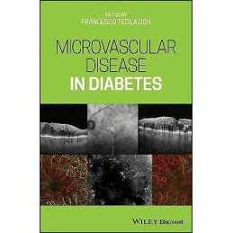 Microvascular Disease in Diabetes - 9781119309604