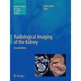 Radiological Imaging of the Kidney - 9783662519035
