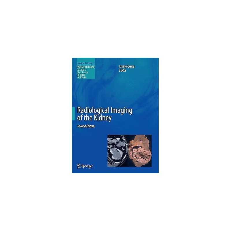 Radiological Imaging of the Kidney - 9783662519035