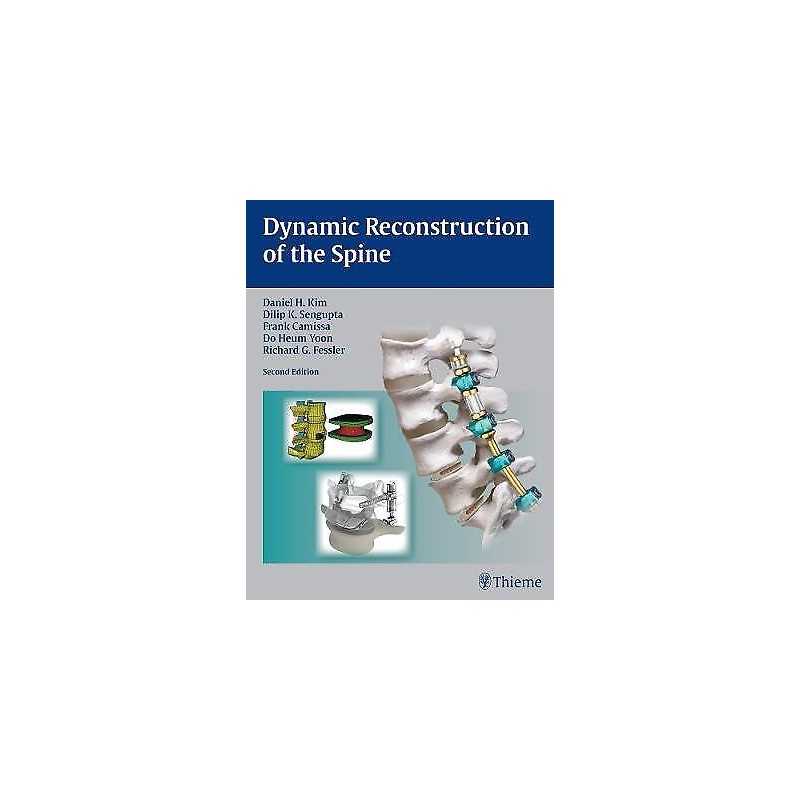 Dynamic Reconstruction of the Spine - 9781604068733