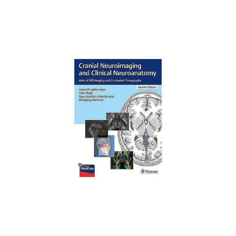 Cranial Neuroimaging and Clinical Neuroanatomy - 9783136726044
