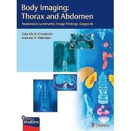 Body Imaging: Thorax and Abdomen - 9783132054110
