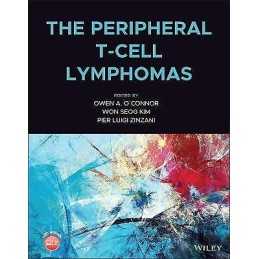 The Peripheral T-Cell Lymphomas - 9781119671312