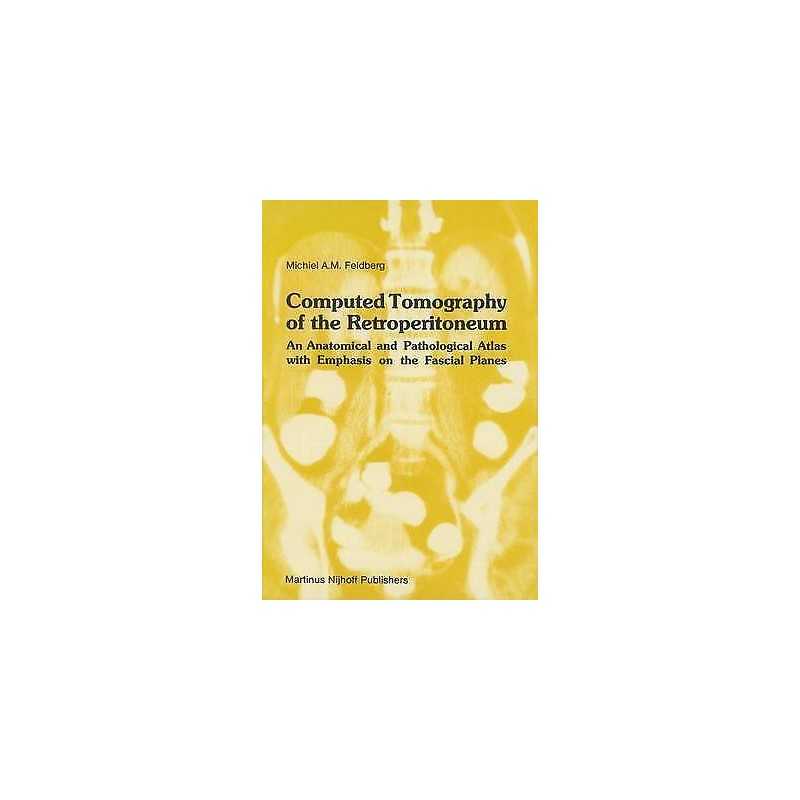 Computed Tomography of the Retroperitoneum - 9780898385731