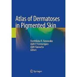 Atlas of Dermatoses in Pigmented Skin - 9789811554858